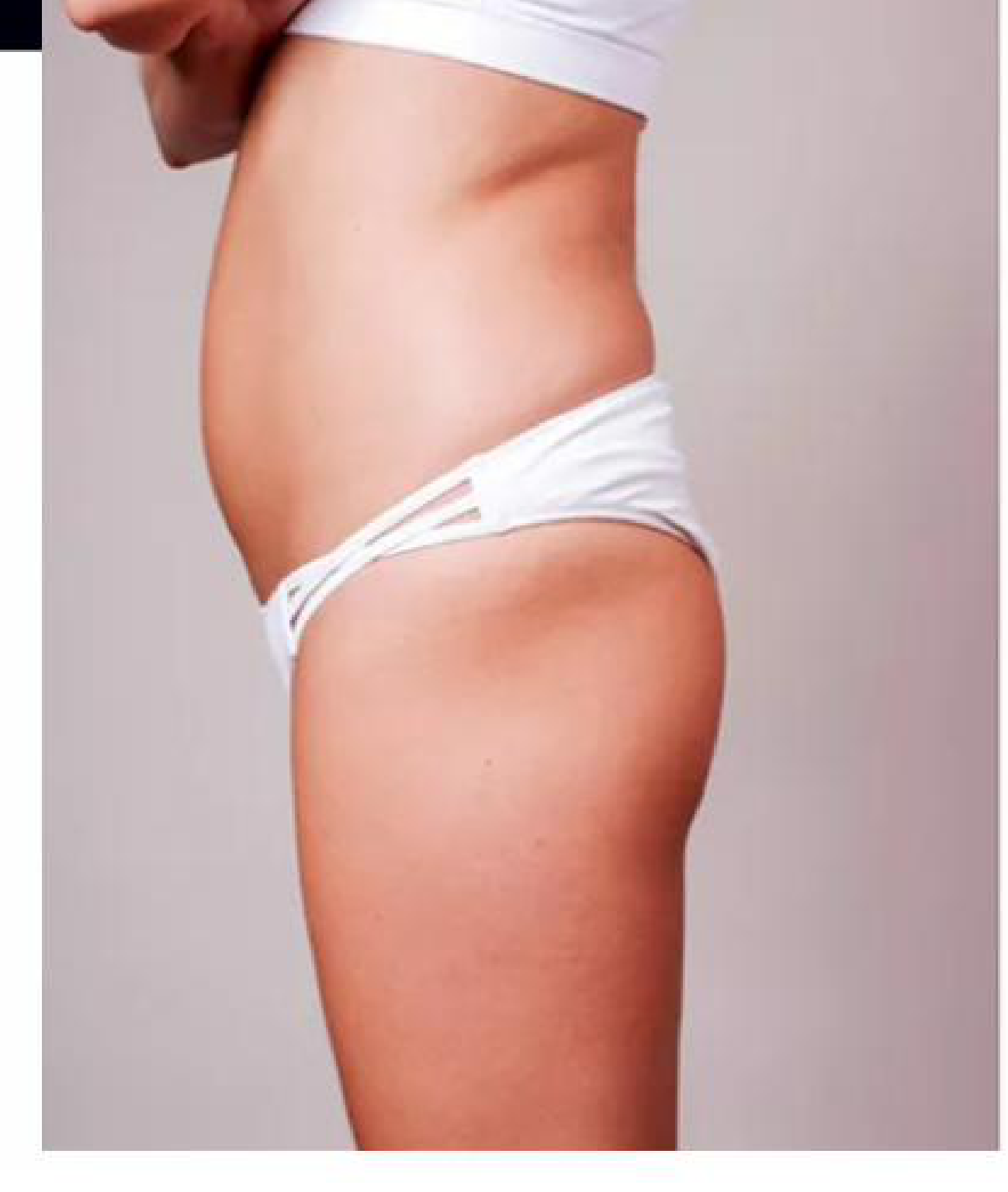 Lipoenxertia / Lipoescultura